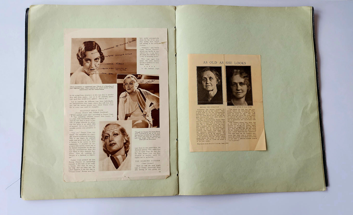 1930s Scrapbook & Ephemera Hollywood Film Star Martha Petelle First Surgical Facelift